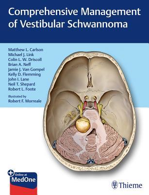 Read online Comprehensive Management of Vestibular Schwannoma - Matthew L Carlson | PDF